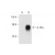 IL-3Rα Antibody (6H6 BOT) - Western Blotting - Image 58690