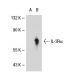 IL-3Rα Antibody (S-12) - Western Blotting - Image 31780