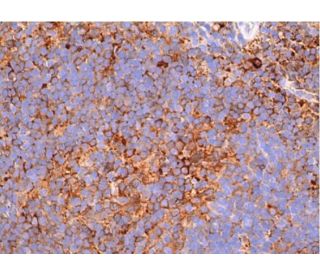 IL-4 Antibody (OX81) - Immunohistochemistry - Image 384139 