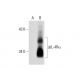 IL-4Rα Antibody (D-2) - Western Blotting - Image 73168