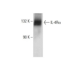 IL-4R&alpha; Antibody (E-1) - Western Blotting - Image 72908 