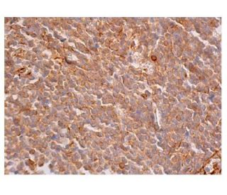 IL-6 Antibody (1) - Immunohistochemistry - Image 352342 