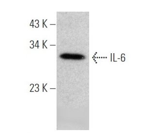 IL-6 Antibody (10E5) - Western Blotting - Image 366614