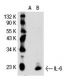 IL-6 Antibody (B-F6) - Western Blotting - Image 30166 
