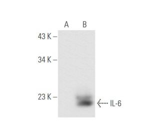 IL-6 Antibody (B-F6) - Western Blotting - Image 62111 