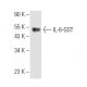 IL-6 Antibody (C12-1-hIL-6) - Western Blotting - Image 8857 