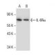IL-6Rα Antibody (D-8) - Western Blotting - Image 286133 