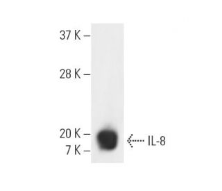 IL-8 Antibody (3E4D8) - Western Blotting - Image 9945