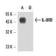 IL-8RB Antibody (5E8) - Western Blotting - Image 16339 