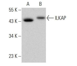 ILKAP Antibody (41) - Western Blotting - Image 378724 