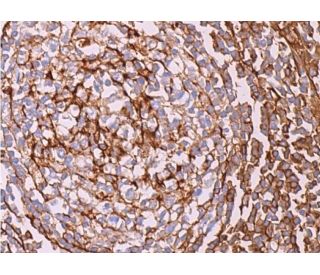 ILT Antibody (H-5) - Immunohistochemistry - Image 377169 