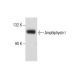Amphiphysin I Antibody (D-6) - Western Blotting - Image 287651
