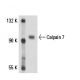 Calpain 7 (G-19): sc-54695. Western blot analysis of Calpain 7 expression in IMR-32 nuclear extract.