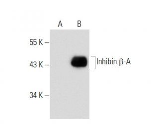 Inhibin β-A Antibody (E-1) - Western Blotting - Image 133993The Double Nickase Plasmid features a U6 promoter for sgRNA expression, a 20 nt targeting sequence, and a gRNA scaffold to guide Cas9n. It includes a CBh promoter for Cas9n (D10A) and puromycin resistance, GFP for transfection verification, and nuclear localization signals (NLS). The 2A peptide allows co-expression of Cas9n and Puro from a single promoter, enabling precise genome editing with reduced off-target effects.