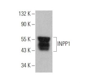 INPP1 Antibody (F-8) - Western Blotting - Image 372857 