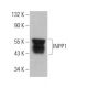 INPP1 Antibody (F-8) - Western Blotting - Image 372857 