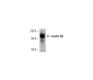 INSR/Insulin Receptor &beta; Antibody (29B4) - Western Blotting - Image 7855