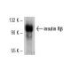 INSR/Insulin Receptor β Antibody (29B4) - Western Blotting - Image 7855