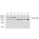 INSR/Insulin Receptor β Antibody (9H4) - Western Blotting - Image 62908