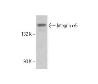 Integrin α5/ITGA5/CD49e Antibody (D-9) - Western Blotting - Image 353264Each CRISPR/Cas9 Knockout (KO) Plasmid product consists of a pool of 3 plasmids designed to ensure identification and cleavage of a specific gene for maximum knockout efficiency. Each plasmid encodes a unique 20 nt sequence derived from the GeCKO (v2) library.