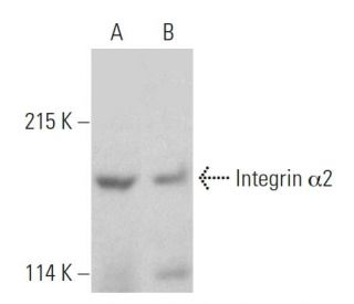 Integrin &alpha;2/ITGA2/CD49b Antibody (244G1) - Western Blotting - Image 389117 
