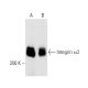 Integrin α2/ITGA2/CD49b Antibody (P4B4) - Western Blotting - Image 14570 