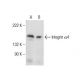 Integrin α4/ITGA4/CD49d Antibody (B-2) - Western Blotting - Image 155295