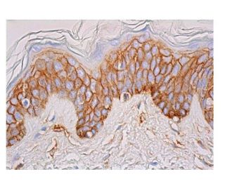 Integrin &alpha;9/&beta;1/ITGA9/ITGB1 Antibody (2Q954) - Immunohistochemistry - Image 348963 