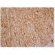 Integrin α9/β1/ITGA9/ITGB1 Antibody (2Q954) - Immunohistochemistry - Image 348962