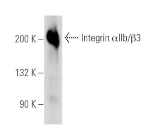 Integrin &alpha;IIb/&beta;3/CD41/CD61 Antibody (P256) - Western Blotting - Image 13977