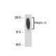 Integrin αL/ITGAL/CD11a Antibody (CRIS-3) - Western Blotting - Image 16272 