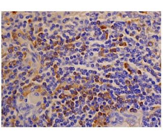 Integrin &alpha;M/CD11b Antibody (VIM12) - Immunohistochemistry - Image 287087