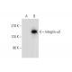 Integrin αX/ITGAX/CD11c Antibody (D-8) - Western Blotting - Image 308118 