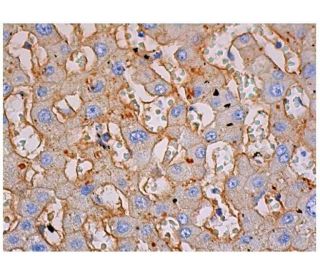 Integrin &beta;1/ITGB1 Antibody (4B7R) - Immunohistochemistry - Image 348961 