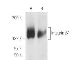 Integrin &beta;1/ITGB1 Antibody (HM&beta;1-1) - Western Blotting - Image 14620 