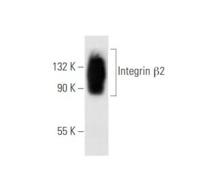 Integrin &beta;2/ITGB2/CD18 Antibody (1.BB.246) - Western Blotting - Image 62622