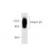 Integrin β2/ITGB2/CD18 Antibody (1.BB.246) - Western Blotting - Image 62622
