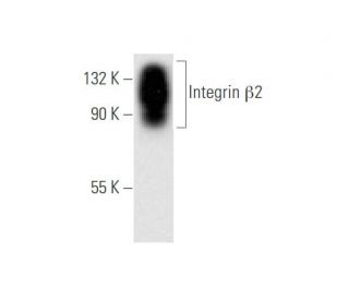 Integrin &beta;2/ITGB2/CD18 Antibody (2Q822) - Western Blotting - Image 62626
