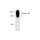 Integrin β2/ITGB2/CD18 Antibody (2Q822) - Western Blotting - Image 62626