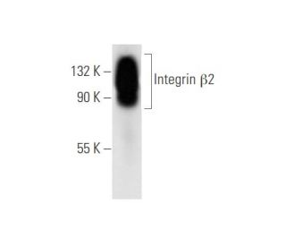 Integrin &beta;2/ITGB2/CD18 Antibody (6A21) - Western Blotting - Image 62625