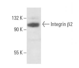 Integrin &beta;2/ITGB2/CD18 Antibody (6G2) - Western Blotting - Image 15484