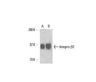 Integrin &beta;2/ITGB2/CD18 Antibody (C71/16) - Western Blotting - Image 17294 