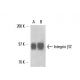Integrin β2/ITGB2/CD18 Antibody (C71/16) - Western Blotting - Image 17294 