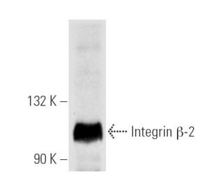 Integrin &beta;2/ITGB2/CD18 Antibody (CTB104) - Western Blotting - Image 5238 