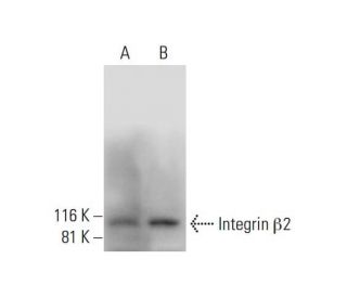 Integrin &beta;2/ITGB2/CD18 Antibody (H-7) - Western Blotting - Image 294115 