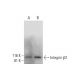 Integrin β2/ITGB2/CD18 Antibody (H-7) - Western Blotting - Image 294115 