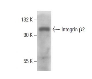 Integrin &beta;2/ITGB2/CD18 Antibody (M18/2.a.12.7) - Western Blotting - Image 18082