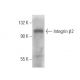 Integrin β2/ITGB2/CD18 Antibody (M18/2.a.12.7) - Western Blotting - Image 18082