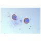 Integrin β2/ITGB2/CD18 Antibody (M18/2) - Immunohistochemistry - Image 5237 