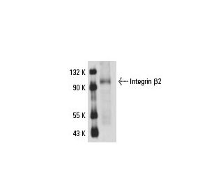 Integrin &beta;2/ITGB2/CD18 Antibody (M18/2) - Western Blotting - Image 18080 